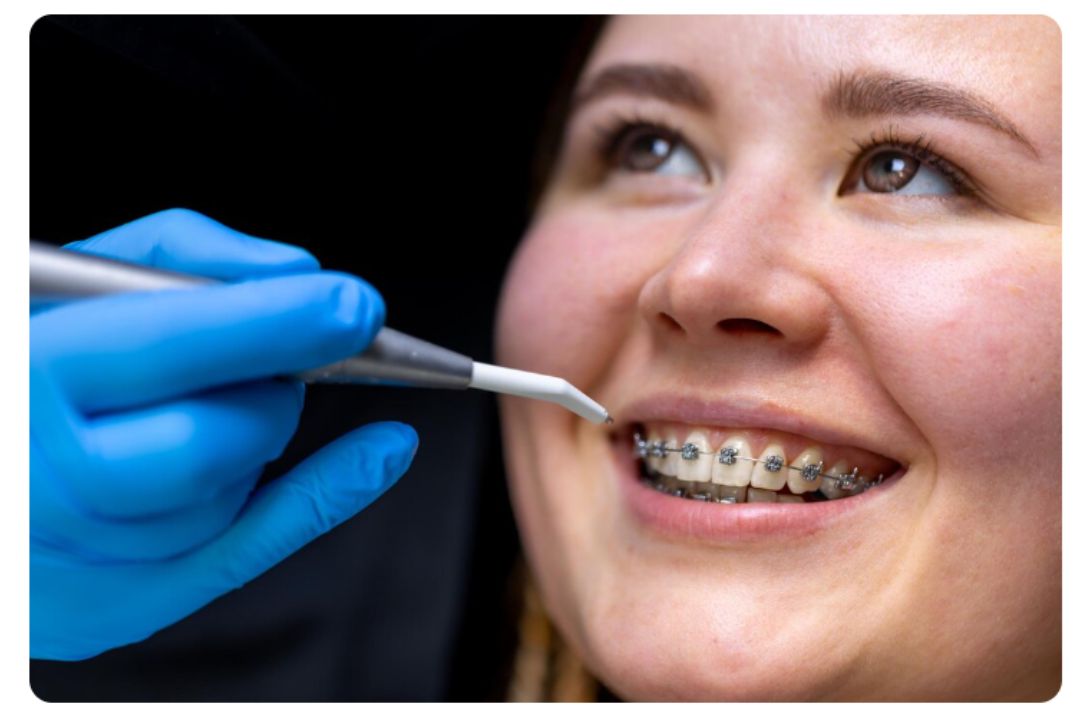 best braces dentist near me